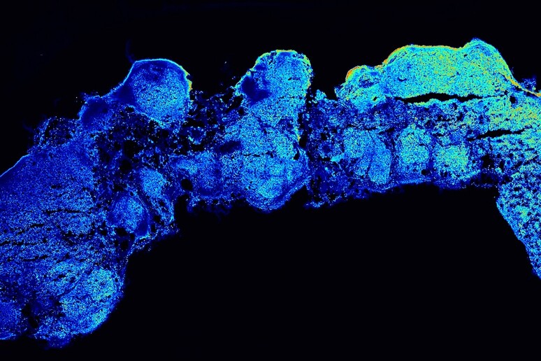 Un organoide allungato della corteccia cerebrale (fonte: Camilla Bosone, IMBA) - RIPRODUZIONE RISERVATA