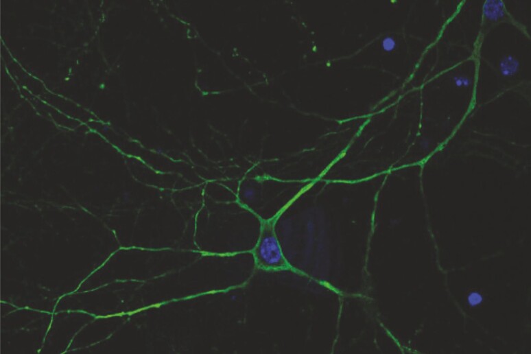 Neurone trattato con la nuova strategia terapeutica (fonte: Istituto Italiano di Tecnologia - © IIT) - RIPRODUZIONE RISERVATA